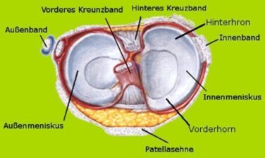 Der Meniskusriss: Eine Unterschätzte Knieverletzung Knie Marathon: Knie ...